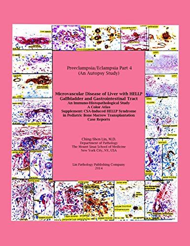 Preeclampsia/Eclampsia Part 4 (An Autopsy Study), Microvacular Disease ...