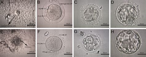 Frontiers | Embryological Characteristics of Human Oocytes With Agar-Like Zona Pellucida and Its ...