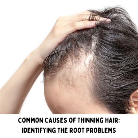 7 Proven Methods to Revitalize Thinning Hair | Clinikally
