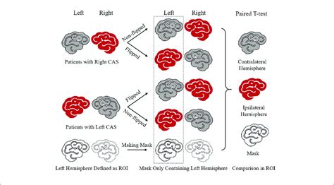 Image result for Contralateral Hemisphere