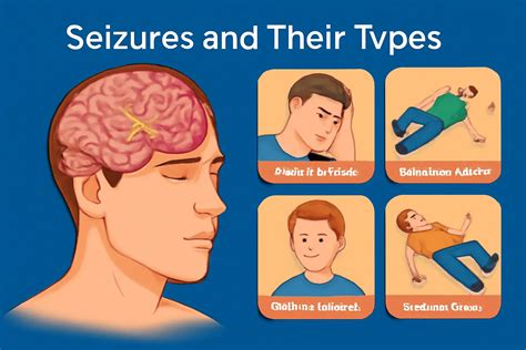 Seizures and Their Types | Classification | Free Notes