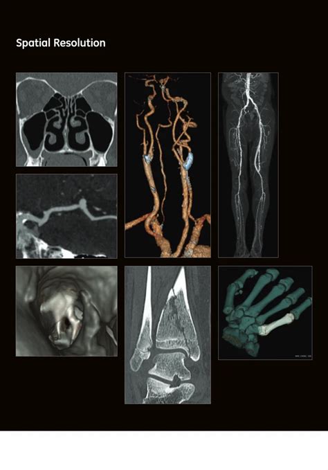 Ct Scan Machines - GE Optima 520 16 Slice Ct Scan machine Service ...