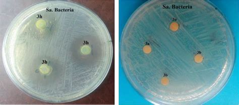 Image result for Disk Diffusion Method Procedure