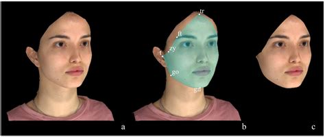 Comparison of Different 3D Surface Registration-Based Methods to Assess ...
