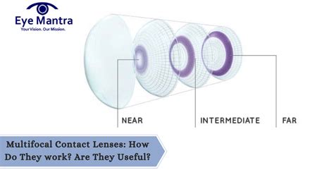 Image result for How Do Multifocal Contacts Work
