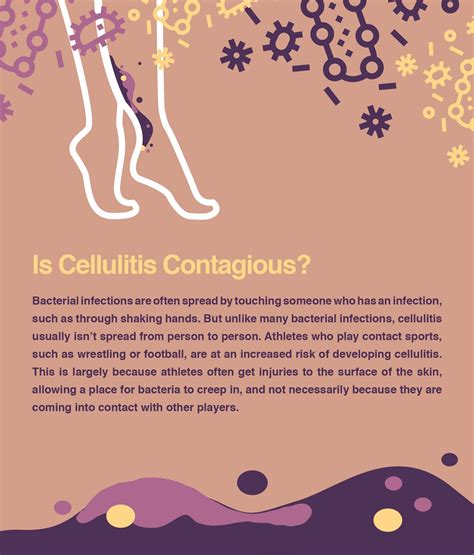 Cellulitis Skin Infection: Causes and How Do to Treat It? – The Amino Company