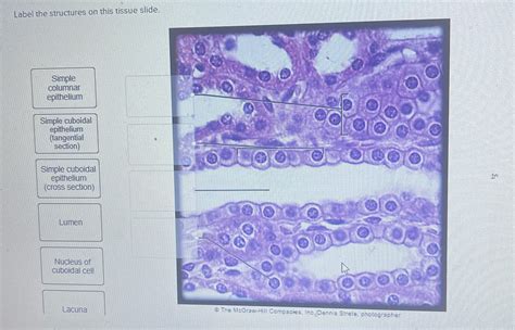 Simple Cuboidal Epithelial Tissue Labeled