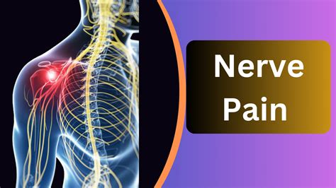 What Cures Nerve Pain