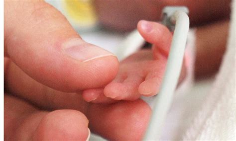 Unvaccinated pregnant patients with rheumatic disease and COVID-19 more ...