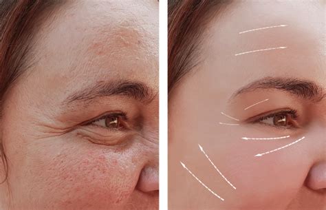 7 Ready Steady Glow ingredients for wrinkles on face - IYURVED-IN