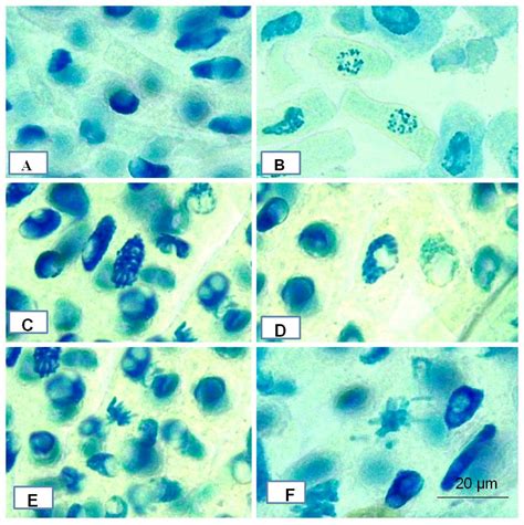 From Ficus recemosa Leaf Galls to Therapeutic Silver Nanoparticles ...