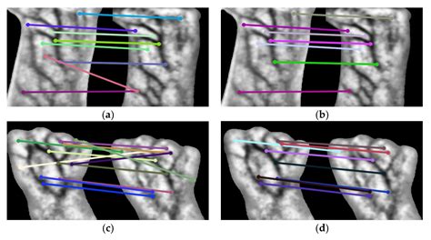 Evaluation of a Vein Biometric Recognition System on an Ordinary Smartphone