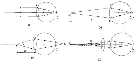 Image result for Class 10th Science Human Eye Chapter