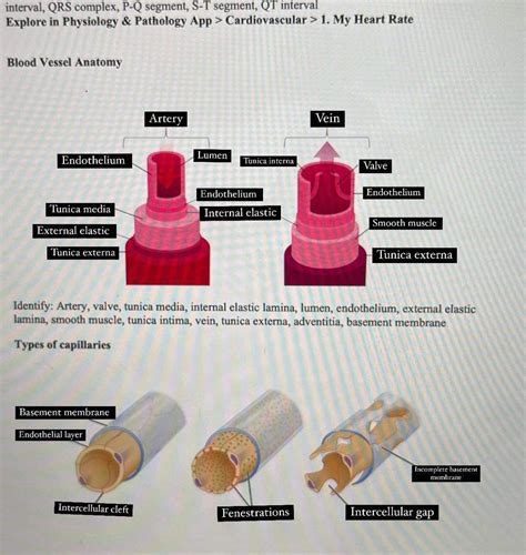 [Solved] Anatomy and physiology. interval, QRS complex, P-Q segment, S-T... | Course Hero