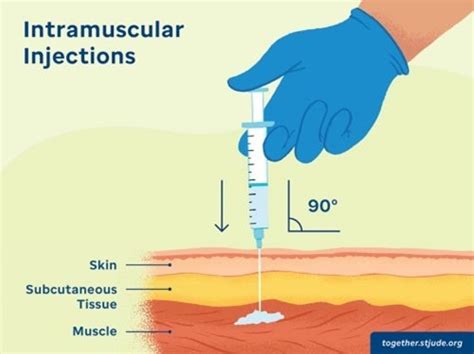 Intramuscular Injection 的图像结果