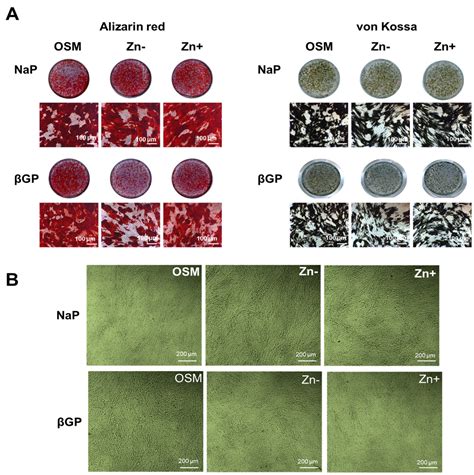Zinc Deficiency Promotes Calcification in Vascular Smooth Muscle Cells ...