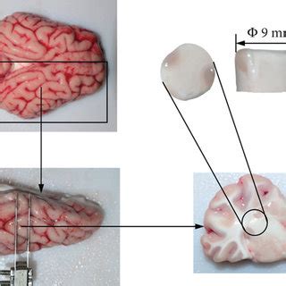 Image result for Brain Tissue Sample