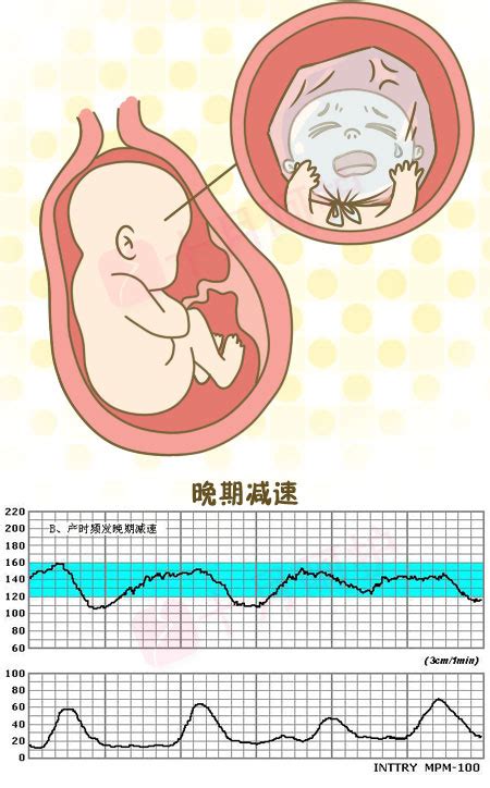 技术活——教你看懂胎心监护！