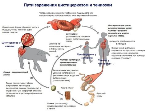 Симптомы и лечение цистицеркоза головного мозга и глаз у человека ...