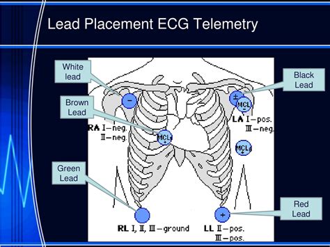PPT - Nursing Interpretation of the Electrocardiogram (ECG), Telemetry ...