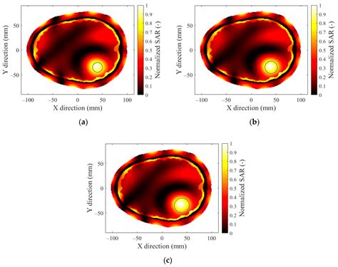 Microwave Hyperthermia of Brain Tumors: A 2D Assessment Parametric ...
