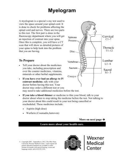 Image result for Myelogram Injection
