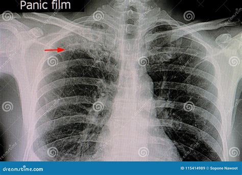 Image result for Alien Bone Spin