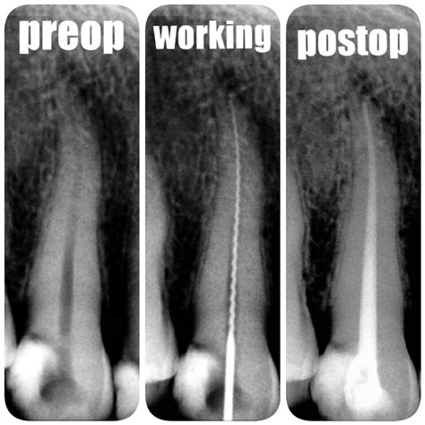 Best Dentist in Patna | Maurya Dental Clinic & Implant Center, Danapur