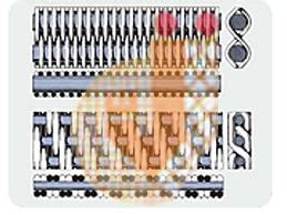 Woven | Open Ended | Ended Wire Mesh | India