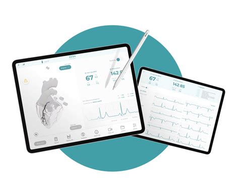 HATO – Next-generation ECG analytics