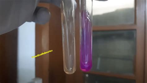 Image result for Urease