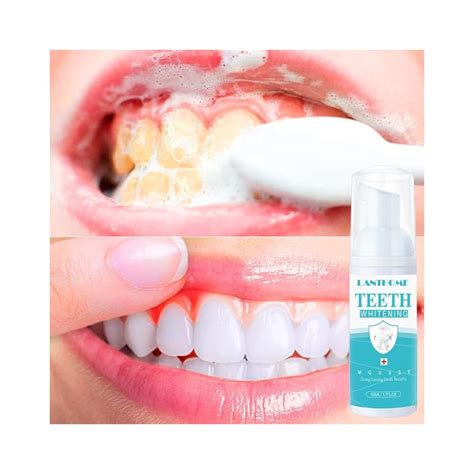Lanthome LANTEHOME Easy-to-Use Teeth Whitening Foam - 3PCS India | Ubuy