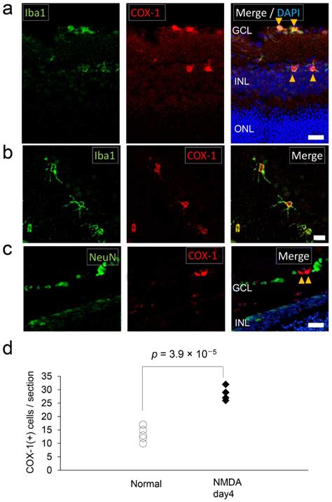 Dynamics of Cyclooxygenase-1 Positive Microglia/Macrophage in the ...