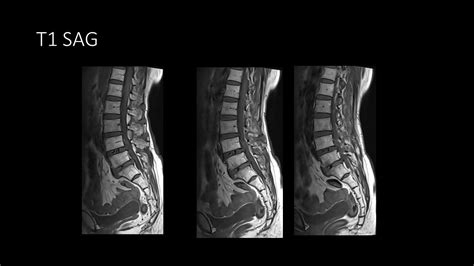 BIR Quiz of the Week