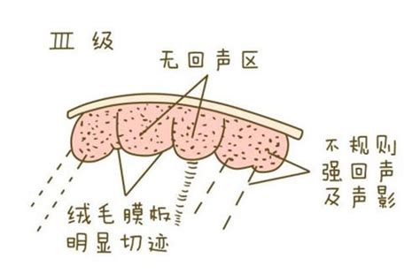 育儿说：38周和40周婴儿的这4个区别不可不知，可要重视了 - 知乎