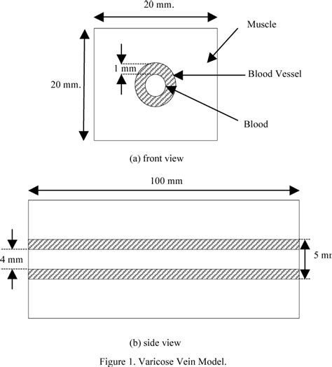 Image result for Multi Dynamic Vena Modeling