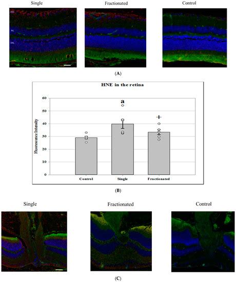 Evaluating Ocular Response in the Retina and Optic Nerve Head after ...