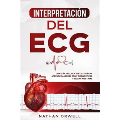 Interpretación del ECG: Una Guía Práctica e | Ubuy India