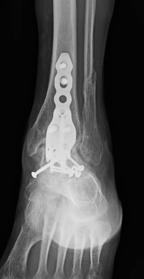 Hardware Monitor Driver 的图像结果