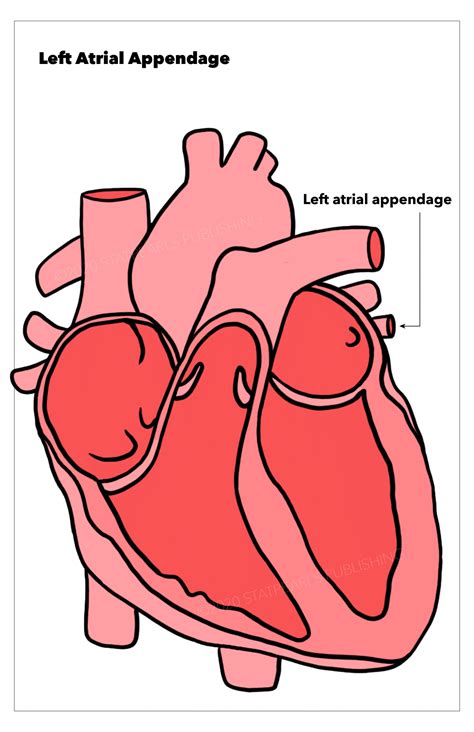 Anatomy, Thorax, Heart Left Atrial Appendage | Treatment & Management | Point of Care