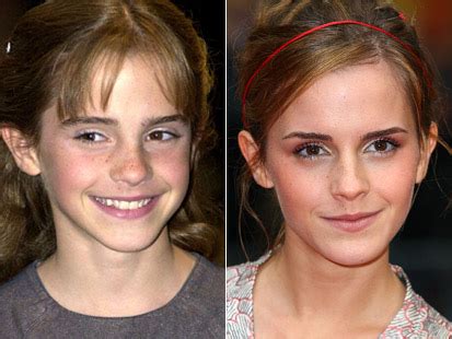 艾玛 沃特森（Emma Watson）小时候照 - 金玉米 | 专注热门资讯视频