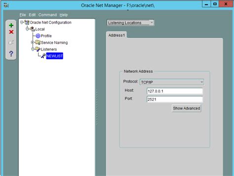 Image result for Oracle Net Manager Problem