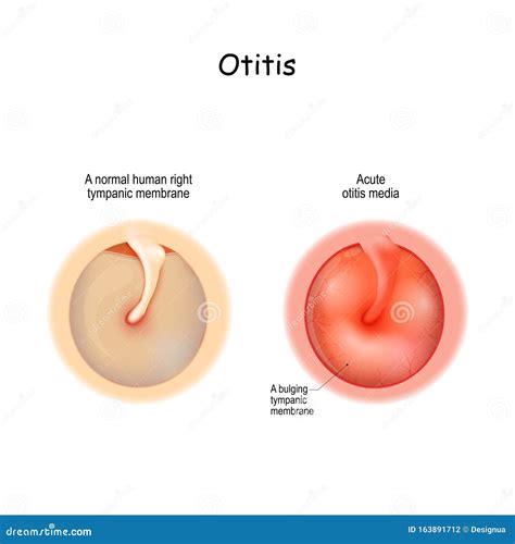 Serous Membrane, Vintage Illustration Cartoon Vector | CartoonDealer ...