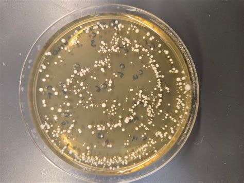 How Vitamin Availability Influences the Virulence of a Pathogenic Yeast ...