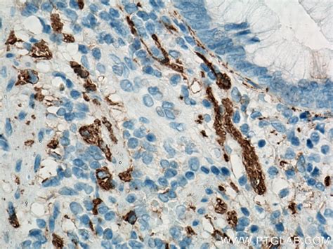 NCAM1/CD56 antibody (14255-1-AP) | Proteintech