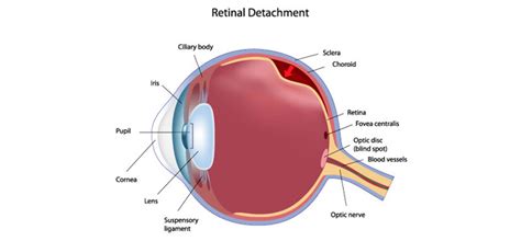 Dr. Ryan D'souza ::: Center for Eye Diagnostics and Surgery, Laser Eye ...