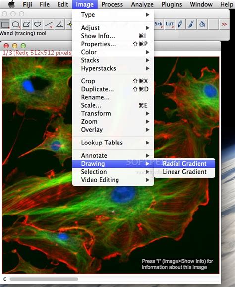 Fiji ImageJ Download 的图像结果