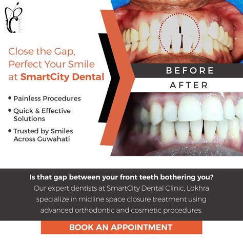 Smartcity Dental Clinic | Guwahati