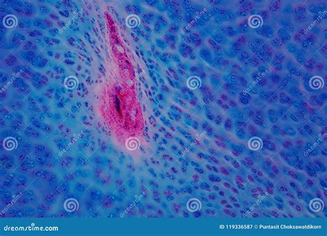 Human Hyaline Cartilage Bone Under Microscope View for Education Stock ...