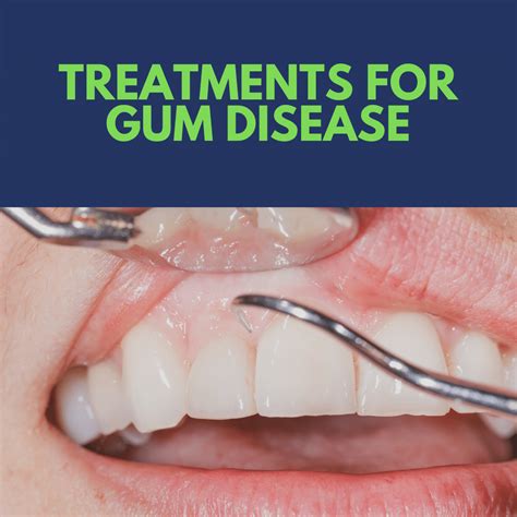 Gum Infection Treatment